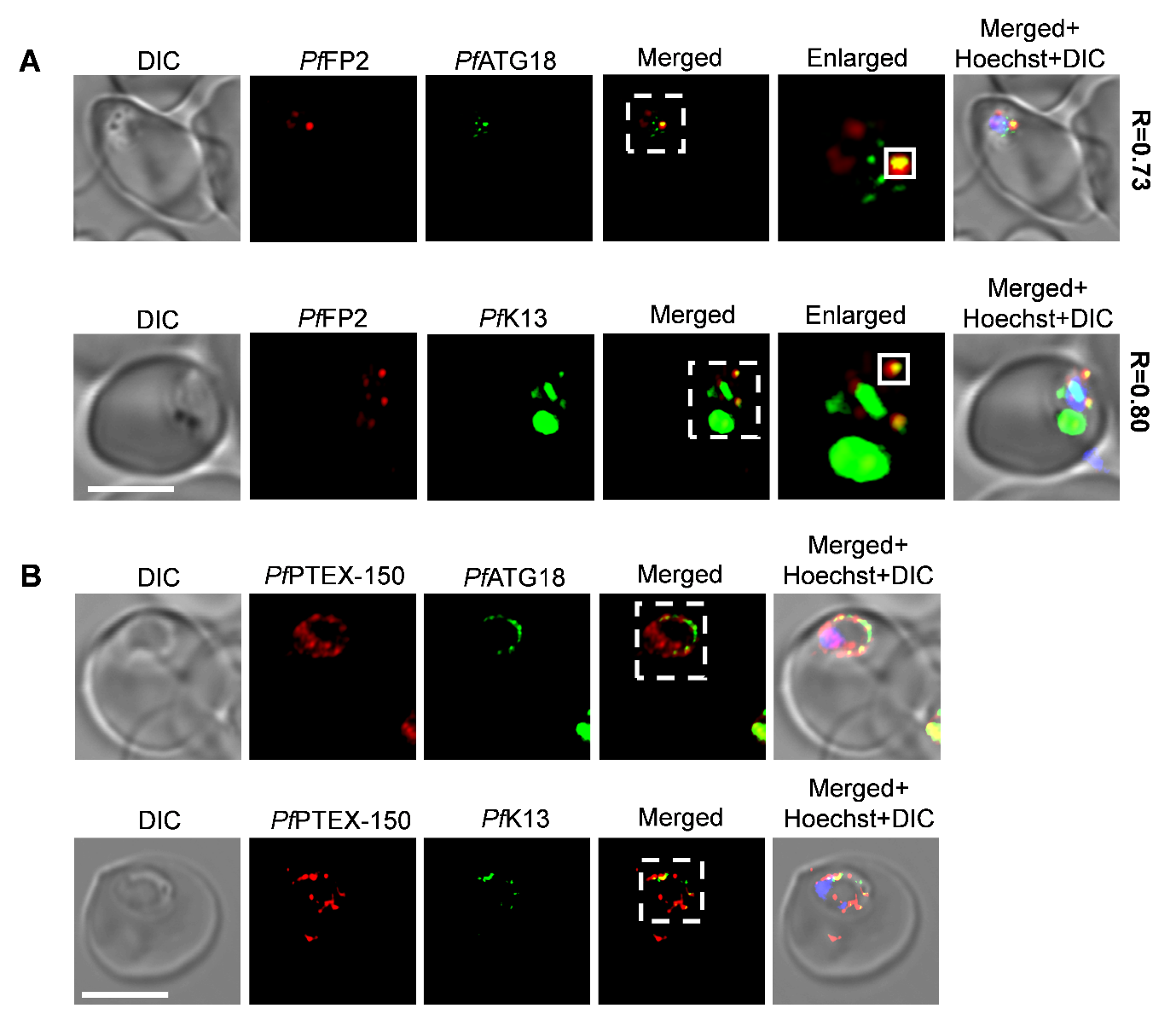 Image of Pf K13 and Pf ATG18 colocalize 